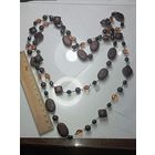 Ожирение . СССР .